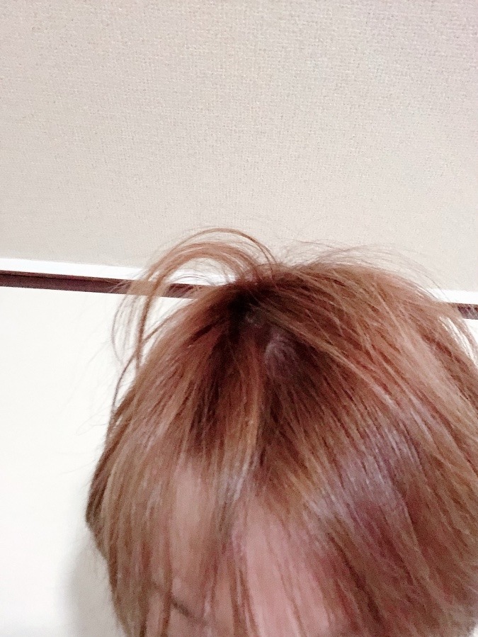 本日の