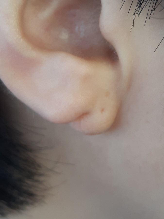 私の耳