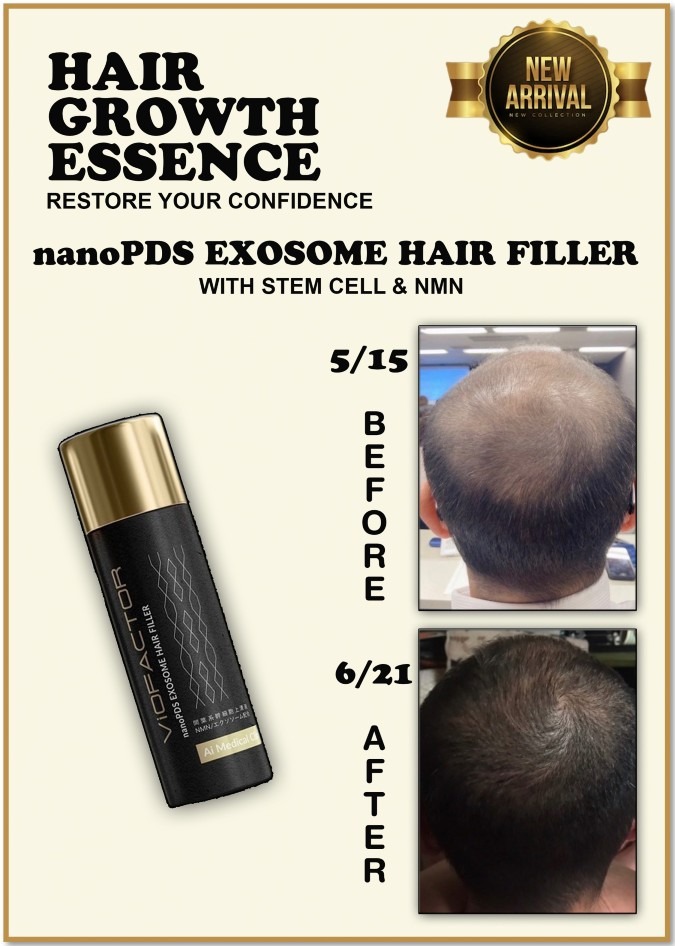 nanoPDS EXOSOME HAIR FILLER