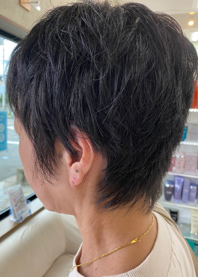 HAIRFILLER開始１1日目横向き✂️