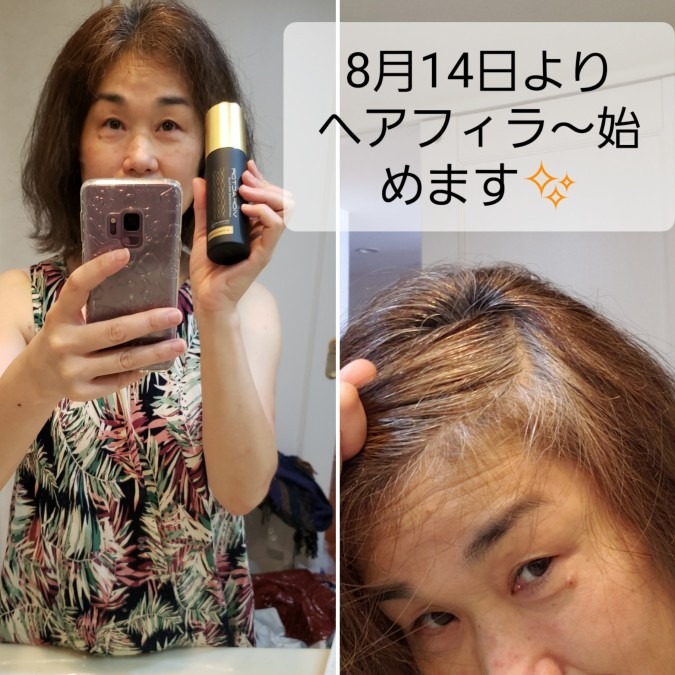 ヘアフィラー届きました✨体験します