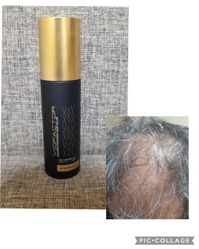 ヘアフィラー
