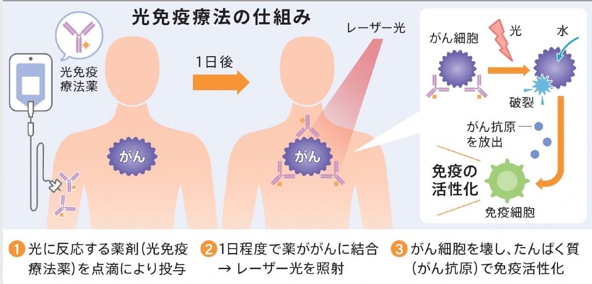 「光免疫療法」　小又誠／癌治療