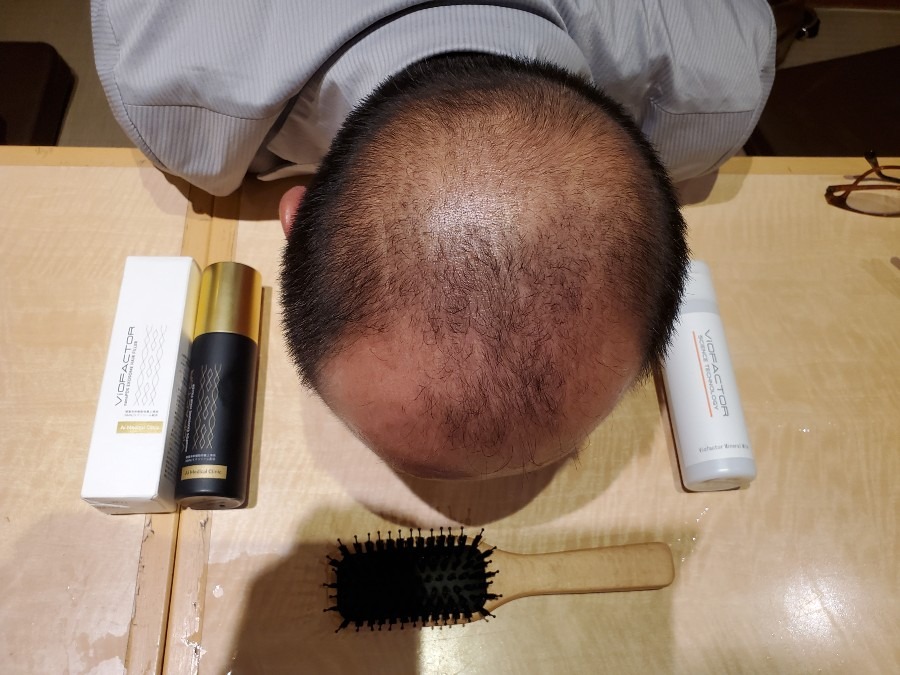 ヘアフィラーモデル