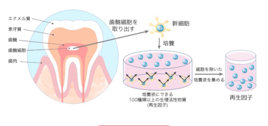 乳歯歯髄由来幹細胞培養上清液　とは。#小又誠/ビジネス