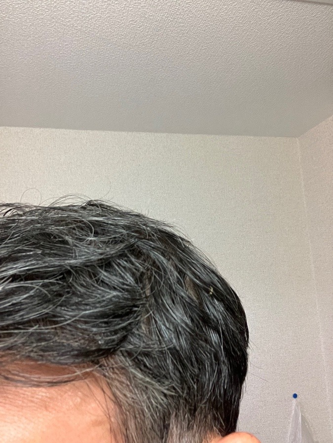 ヘアフィラー使ってみました