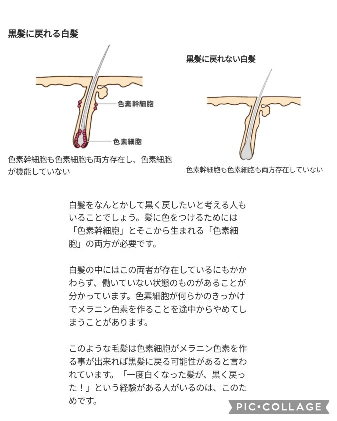 白髪になるメカニズムを知ろう！