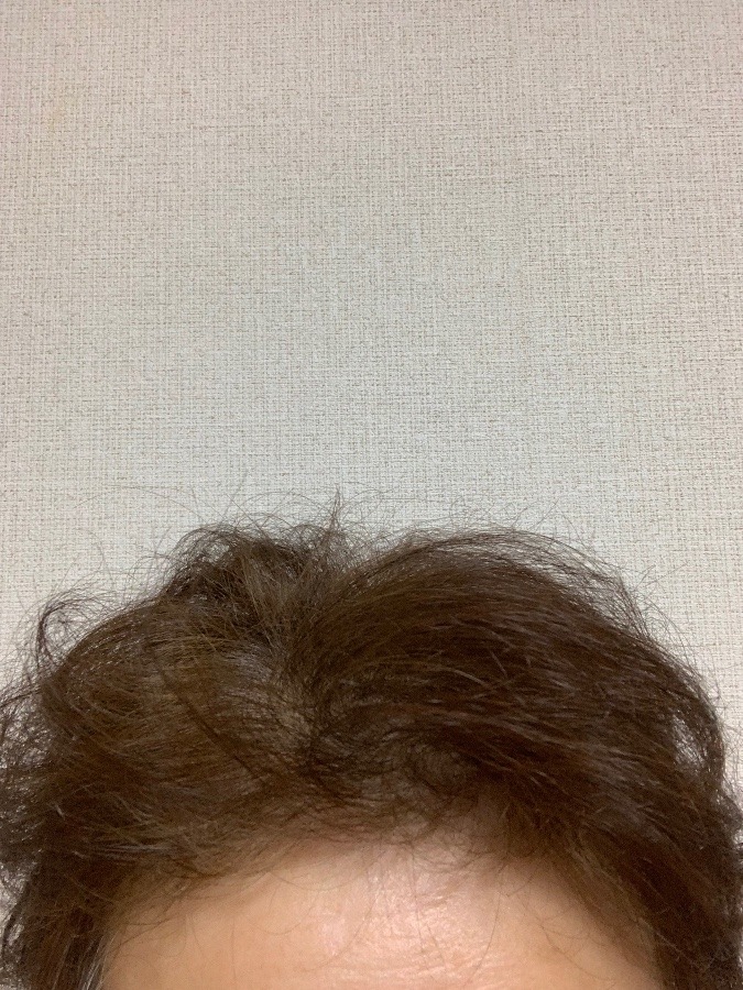 寝癖