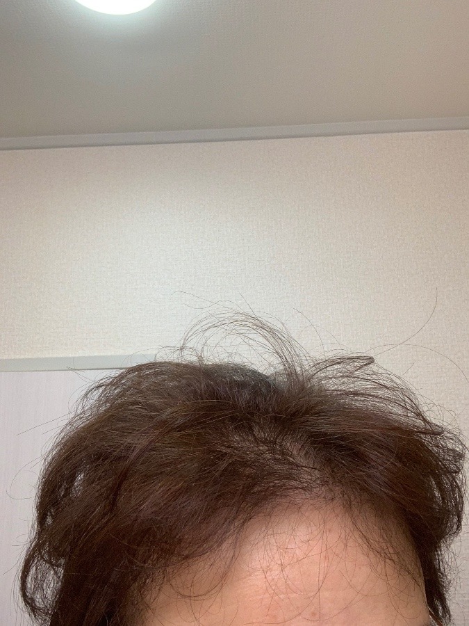 寝癖