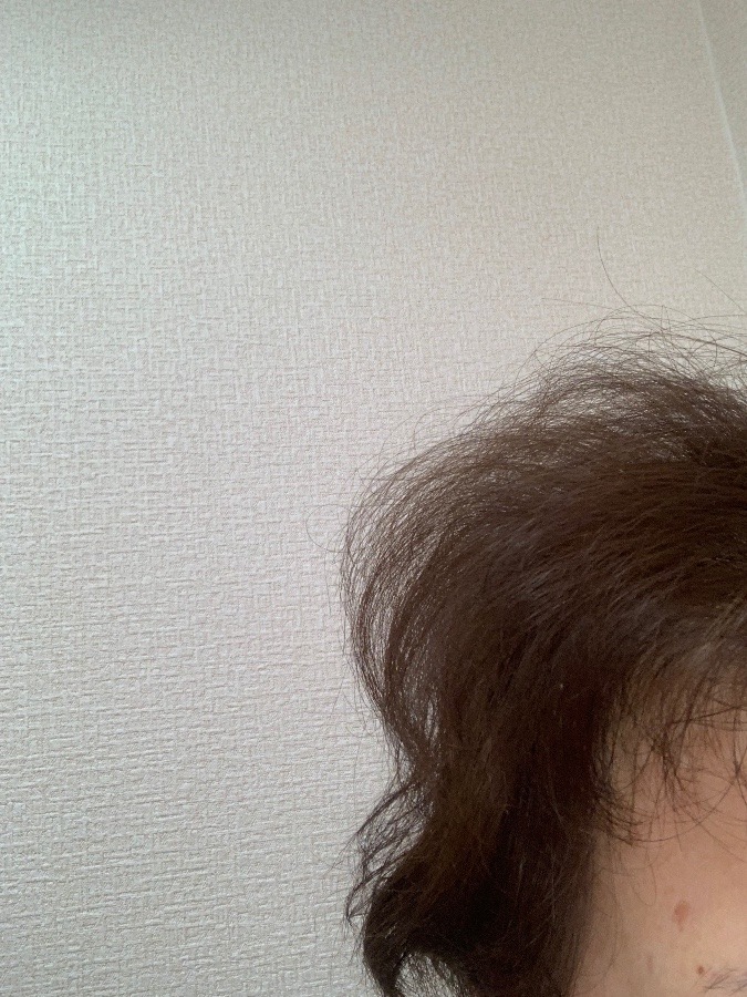 寝癖